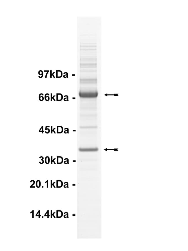 Eurofins DiscoverX Cdk3/Cyclin E Protein, Active Quantity 10 μg Eurofins DiscoverX Cdk3/Cyclin